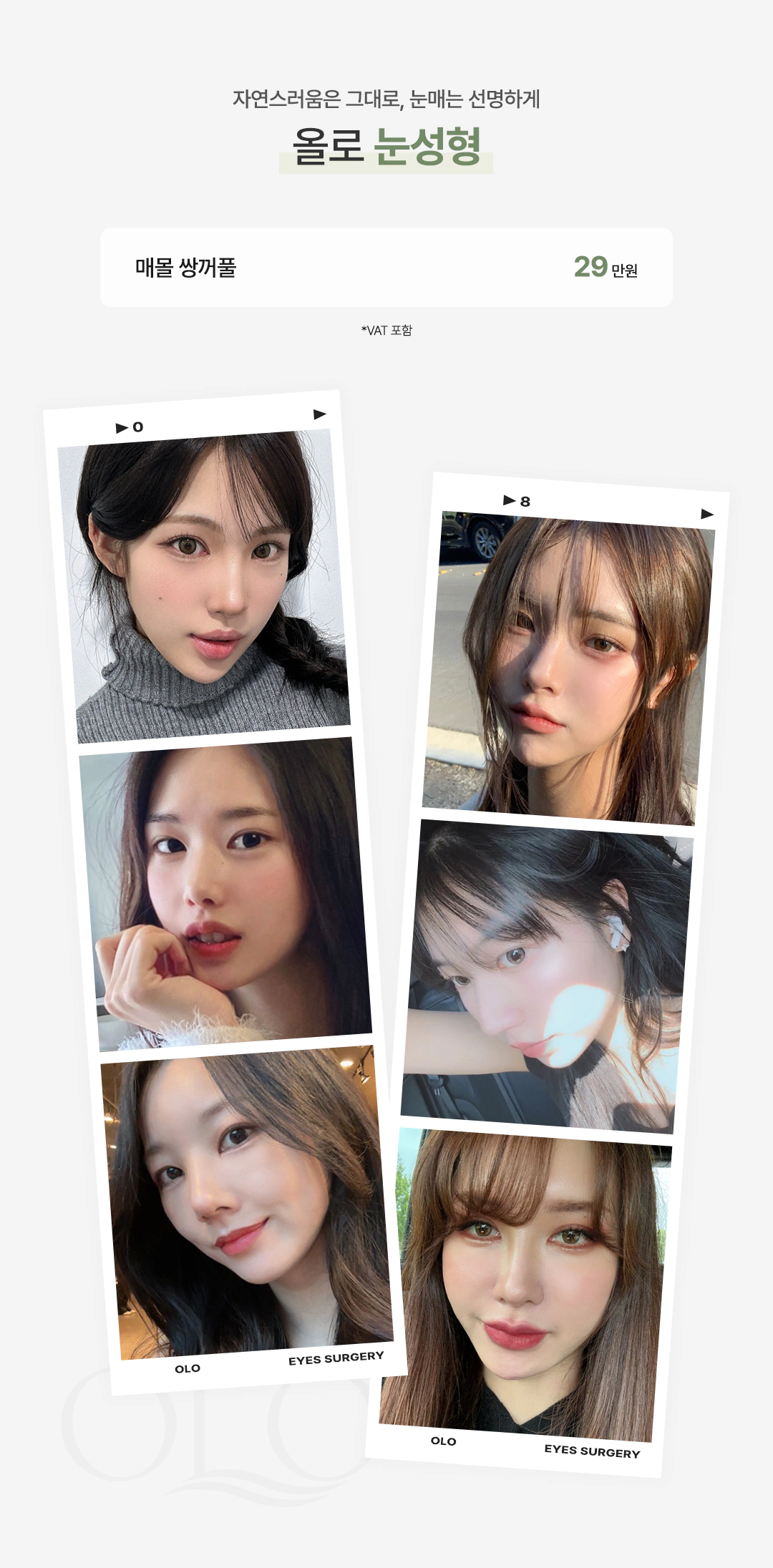 올로 매몰 쌍꺼풀 이벤트 가격 안내
